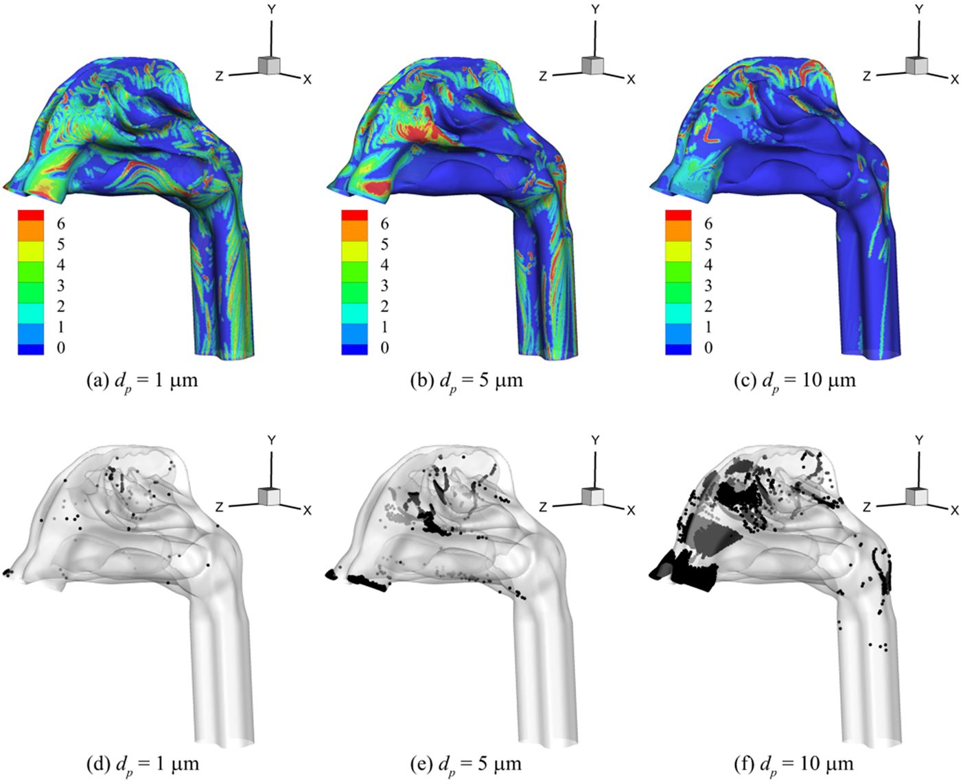 Patient-specific airway CFD simulation